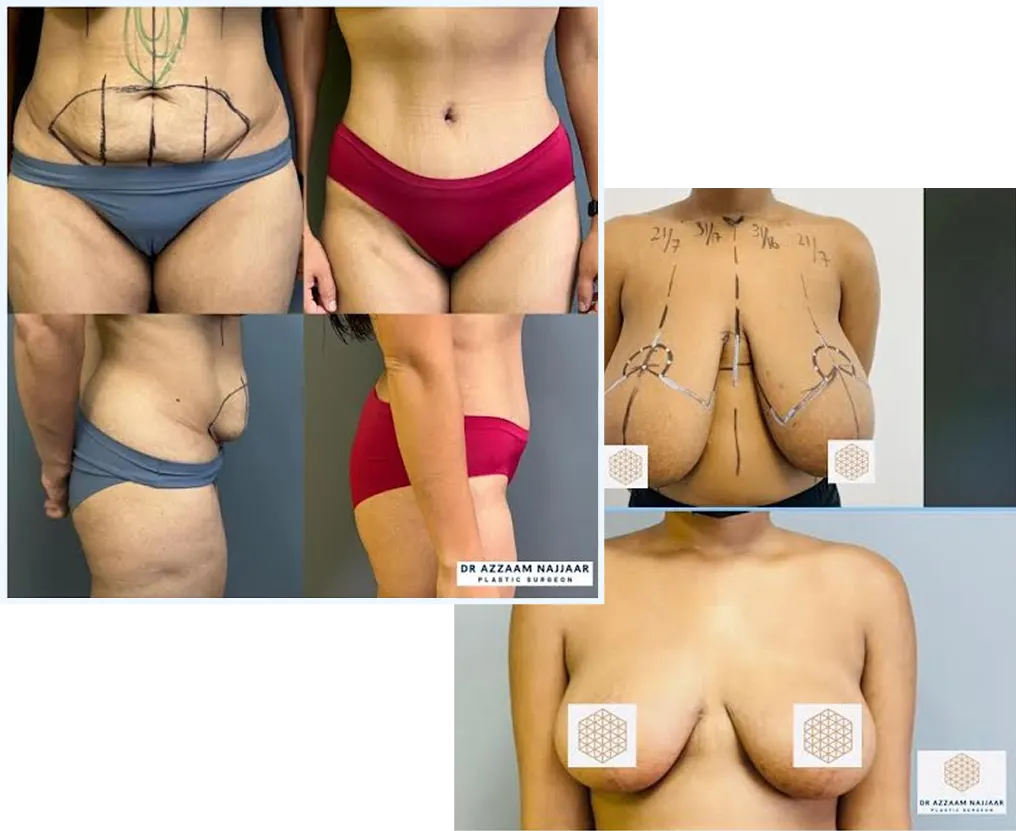 Before and after cosmetic surgery photos